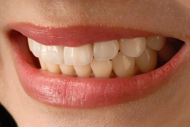 veneers-640x480-89834768.jpeg