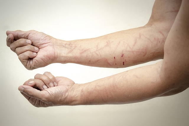 catastrophic-injuries-640x480-96788682.jpeg