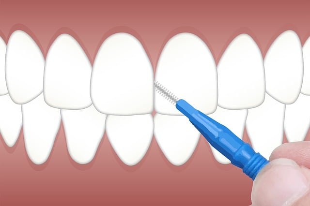 dental cleaning