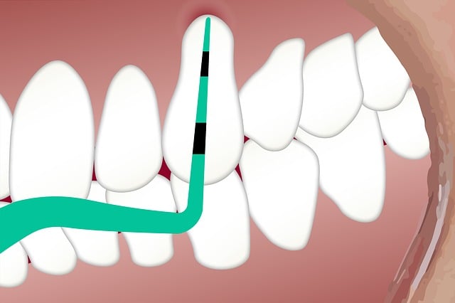 dental cleaning