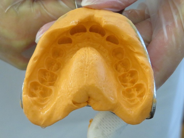 dentures dentistry