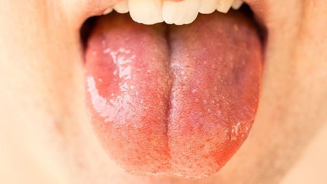 oral health