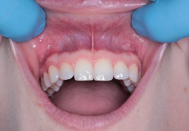 oral hygiene