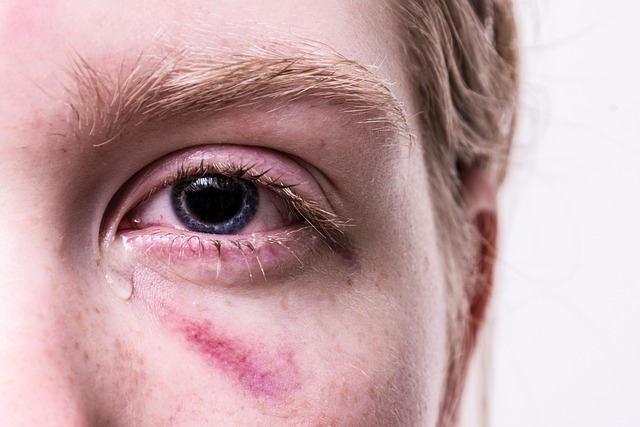 personal injury law