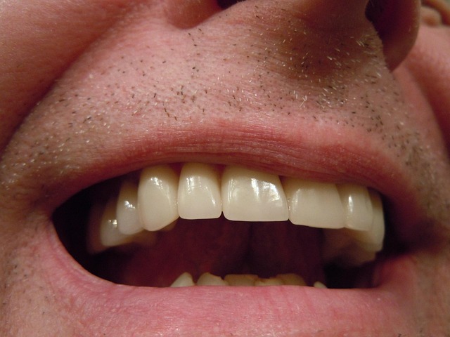 prosthodontics dentistry