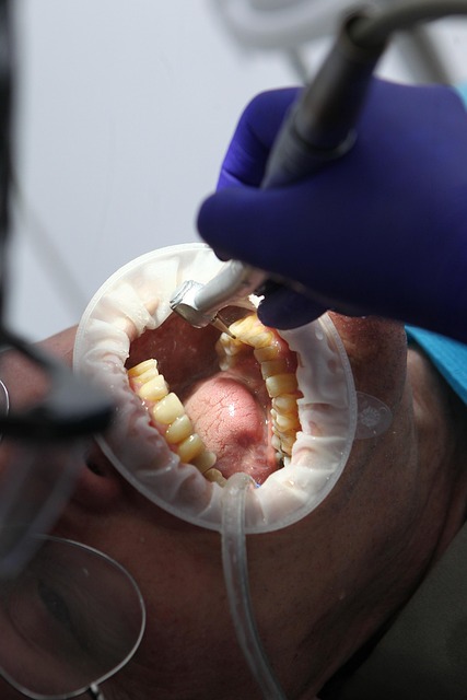 teeth grinding solutions