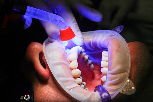 teeth whitening
