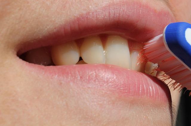 dental cleaning