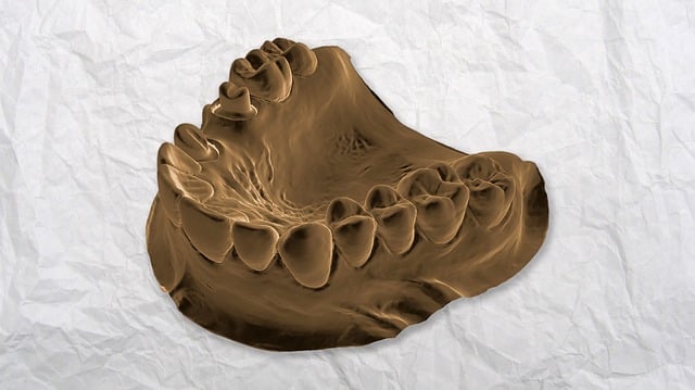 dentures dentistry