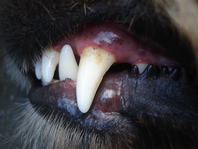 teeth whitening