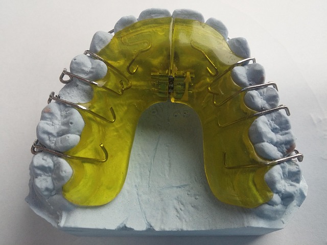 tooth-braces-640x480-32898342.jpeg
