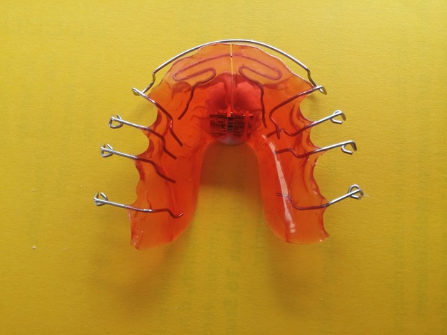 tooth braces