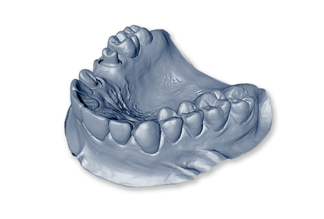tooth extractions