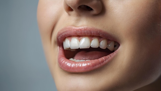 wisdom teeth dentistry